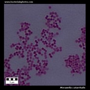 moraxella catarrhalis microscopy